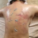이공계뷰티피부샵 | 사하구피부관리 잘하는 곳 찾는다면! 이공계 뷰티샵 등관리 솔직 후기