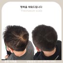 더 채움 스칼프