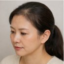번헤어 바이(by) 증모가발 토탈샵