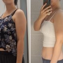 천호마스타 | 천호다이어트 비만클리닉 팔뚝 지방추출주사 후기(육아맘 다이어트 6주차)