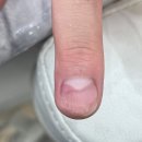 문제성 손, 발 오감네일 이미지