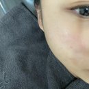 ICHEON111 | [경기도/이천] 아비에 피부 왁싱 이천점 :: 하이닉스 근처 피부샵에서 효과 좋은 여드름관리 후기