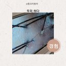 황골신명·한국 | 두피 하다 원장님 수원두피관리