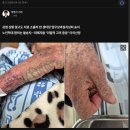 옴 악화에 '코끼리 피부' 된 90대 노인 이미지