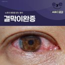 ABC안과의원 이미지