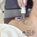 차뷰티 | 보라매 여드름 피부관리 받고 피부 확 바뀐 디또뷰티 2회차 후기