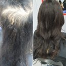 김호증모