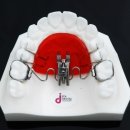 스타치과기공소 이미지