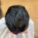 르네시떼 이미지