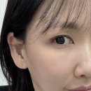 명동프라자 | 명동보톡스 을지로 피부과 추천 후기