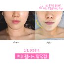 샤이니 토탈 스킨케어