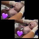 11650-7-6-4 | 👶🏻 천안 연세하임 산부인과 제왕절개 6박7일 | 4인실 후기