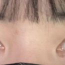 팝성형외과의원 이미지