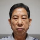 눈 커지고 편해지는 중년 눈썹 거상술 하안검 후기(압구정 성형외과)