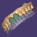 퍼스널치과기공소 이미지