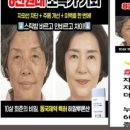 동국헬스케어엠앤아이 주식회사 | 소비자단체, 동국헬스케어엠앤아이㈜ 부당광고 고발…허위사진 사용 소비자 기만