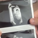 양지산부인과의원 네이버블로그