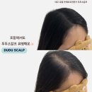 두두스칼프