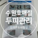 모리온두피탈모 이미지