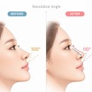 로아한의원 네이버블로그