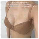 더멘토성형외과의원 | 멘토 스무스 후기 분석: 리플링, 부작용 가능성과 보형물 충전율, 촉감의 상관관계까지