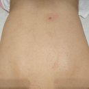 강서필병원 | 등관리 받으러 갔다가 제대로 케어받고 온 날 – 마곡 에스떼벨라 바디필관리 후기