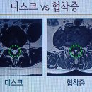 디스크협착증 치료잘하는전주야간진료 송천동 해나무한의원 이미지