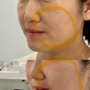 뷰티콜라겐대구지사