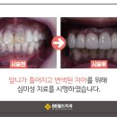 88월드치과의원 네이버블로그