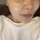 울산 피부관리 올가드림뷰티 PDRN물광관리 후기