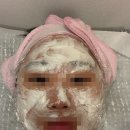 수원역광장 한의원 | [수원 편평사마귀 성지] 무제한 편사 제거 후기 / 어븀야그레이저 / 수원역 한의원 내돈내산
