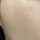 전주메디칼 | 2cc l 더마샤인 ㅣ크라이오 진정 관리 ㅣ스킨부스터ㅣ가격ㅣ통증ㅣ내돈내산 전주 피부 시술 후기 ✨