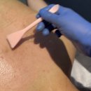 광원프라자 | 답없는 등모공각화증 진접피부관리 전문샵 올바른뷰티에서 관리받은 후기