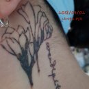 클린타투의원 | (내돈내산/치료완료3년후 후기)클린타투의원 11회차 문신 지우기 치료완료 후 3년 지난 솔직후기! (마취X)