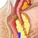 리터닝성형외과의원 이미지