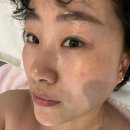 중1동 주민센터 | 부천 중동 피부관리 &lt;란스킨 에스테틱&gt;- 리서페이스 2040 관리 후기