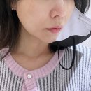 6 | 대구 티타늄리프팅 솔직후기 6일 지나고 느낀 차이