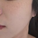 힐스테이트모비우스 | 안양 범계 피부관리 퀸즈테라피 산전산후 관리부터 유기농 아로마관리까지 완벽케어