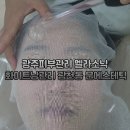 서구-01-115 | 광주피부관리 멜라소닉 화이트닝관리 광천동 문에스테틱