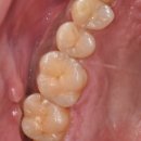 투명한 치과기공소 이미지