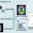 치매 발병전 미리 알려줍니다”비싼 장비 없이 정확도 82%[허진석의 ‘톡톡 스타트업’] 이미지