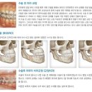 [연예인도 한다는 양악수술] 양악수술이 대세?? 양악수술이란 무엇인가?? 이미지