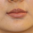 르에이치의원 이미지