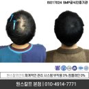 원스칼프 이미지