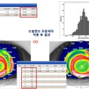 올쏘플러스 이미지