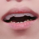 디메디코리아 이미지