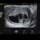 리안산부인과의원 이미지