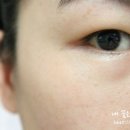 이노메디칼 이미지