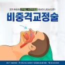 코아코