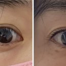 아이오니 뷰티(IONI BEAUTY) 네이버블로그
